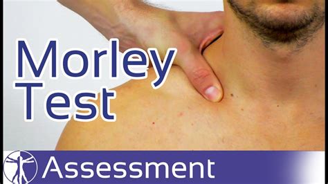 morley compression test|Brachial Plexus Compression Test .